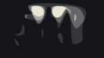 I See Stars