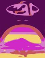 311