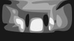 Bell Witch