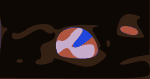 Dead & Company Sphere MSG