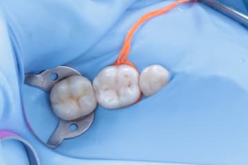 Higiene + pulido (30s)