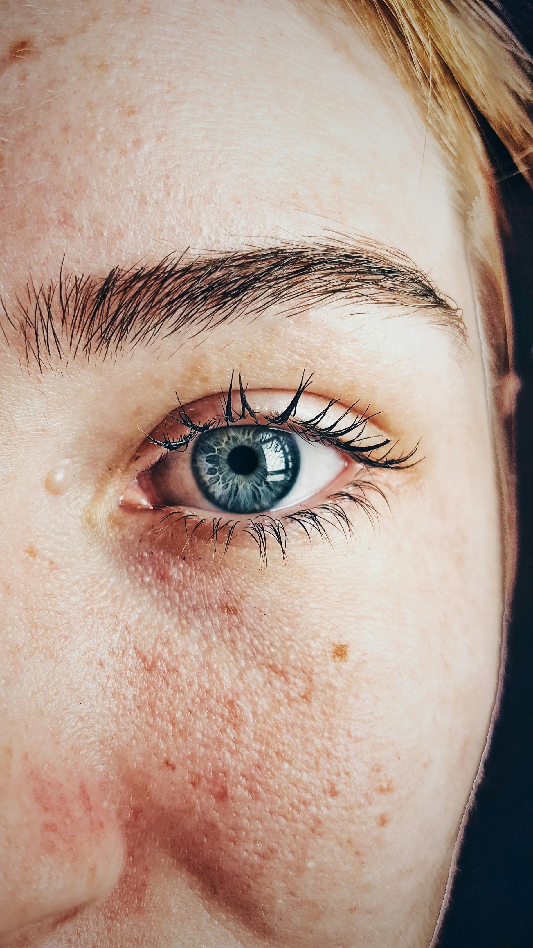 Human eye