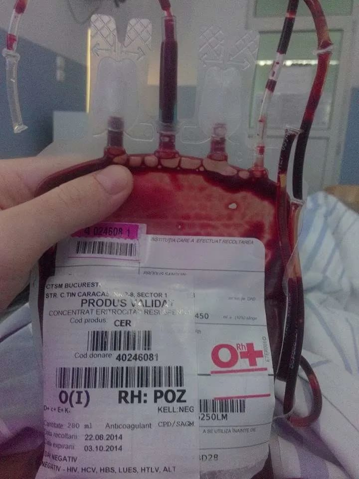 Blood transfusion at Bucharest hospital, August 2022
