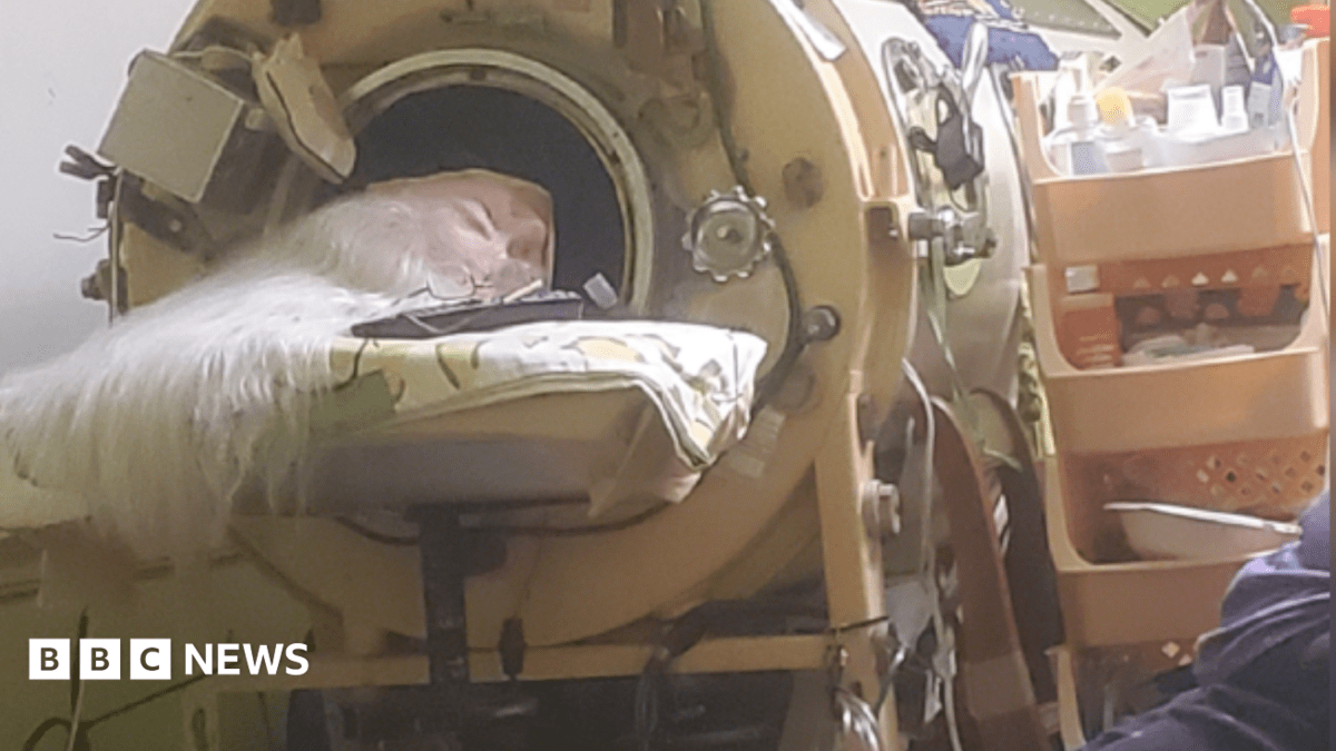 Hours each day in an iron lung kept her breathing, her will to live kept her alive