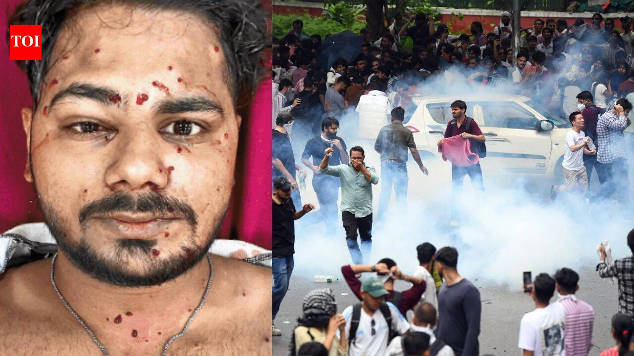 ‘I thought he was only trying to scare me’: Youth in the line of pellet gun fire at CJP protest