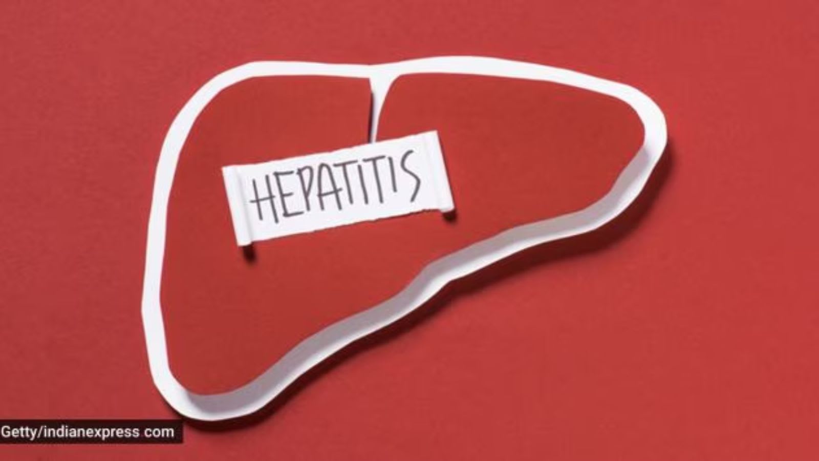He treated jaundice at home: Doctors found hepatitis B and a failing liver
