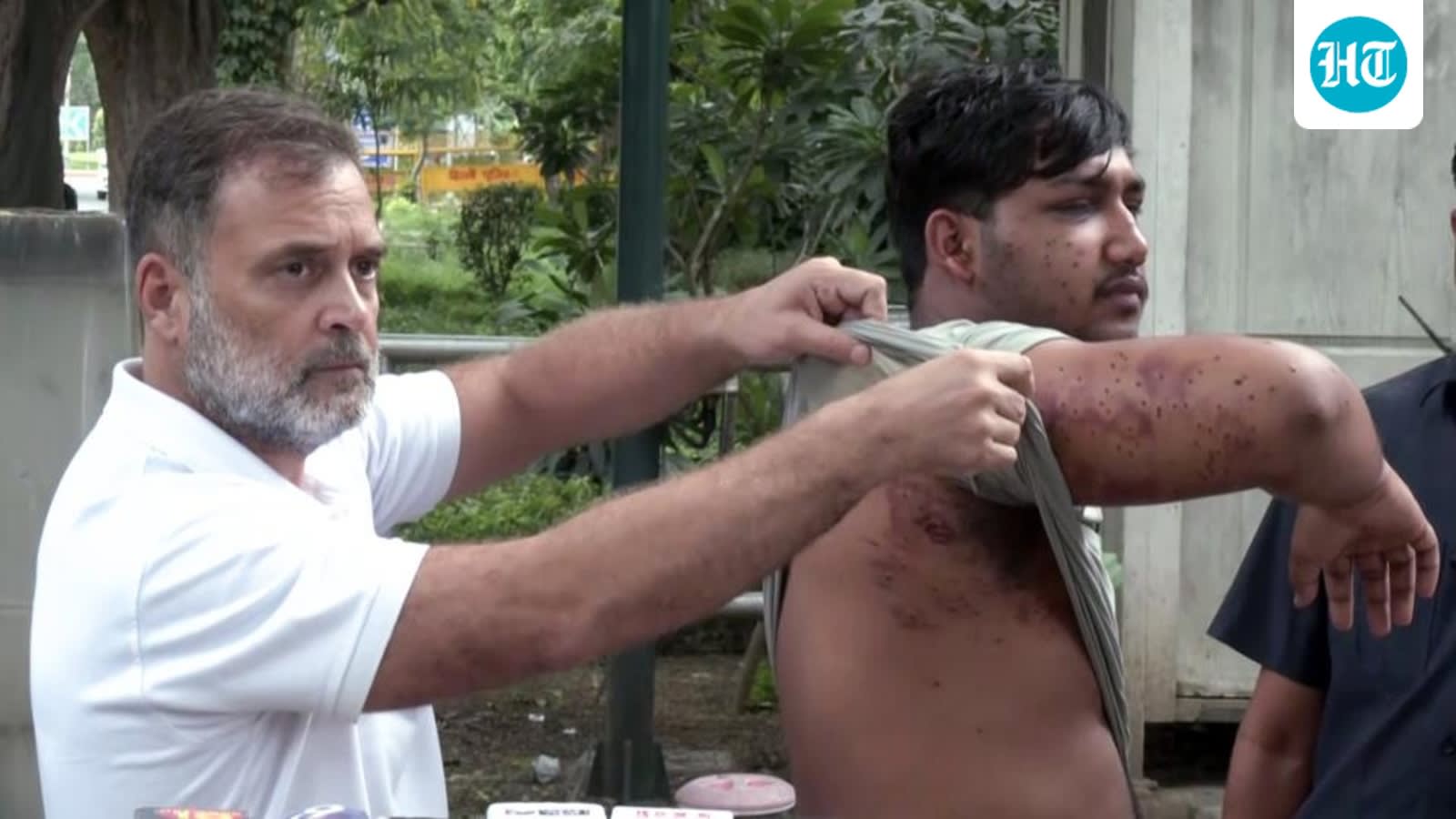 Modi govt says no ‘goli’ fired at CJP protest, but Rahul sticks to ‘pellets’ claim, cites medical evidence