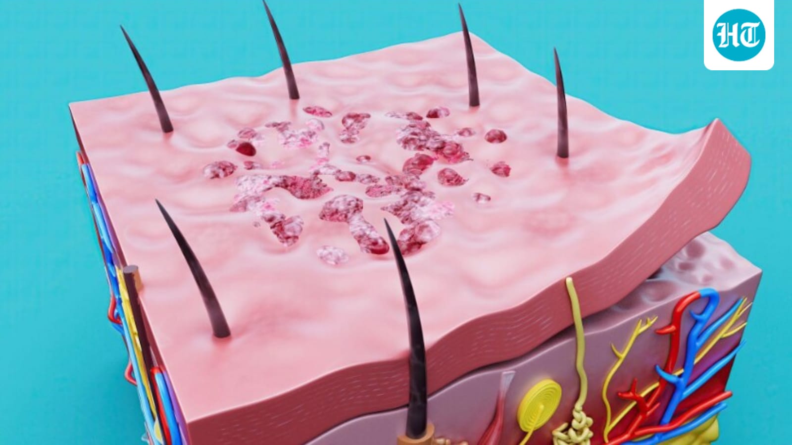 Understanding hair follicles and their growth cycle