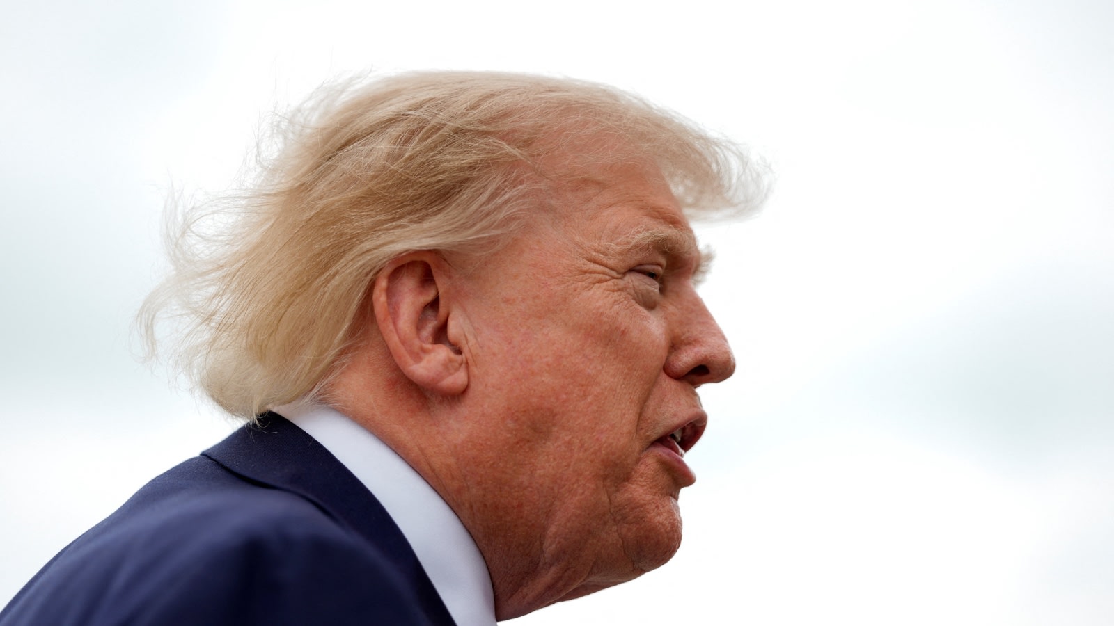 Trump’s health under scrutiny: Cardiologist raises 7 questions about his care