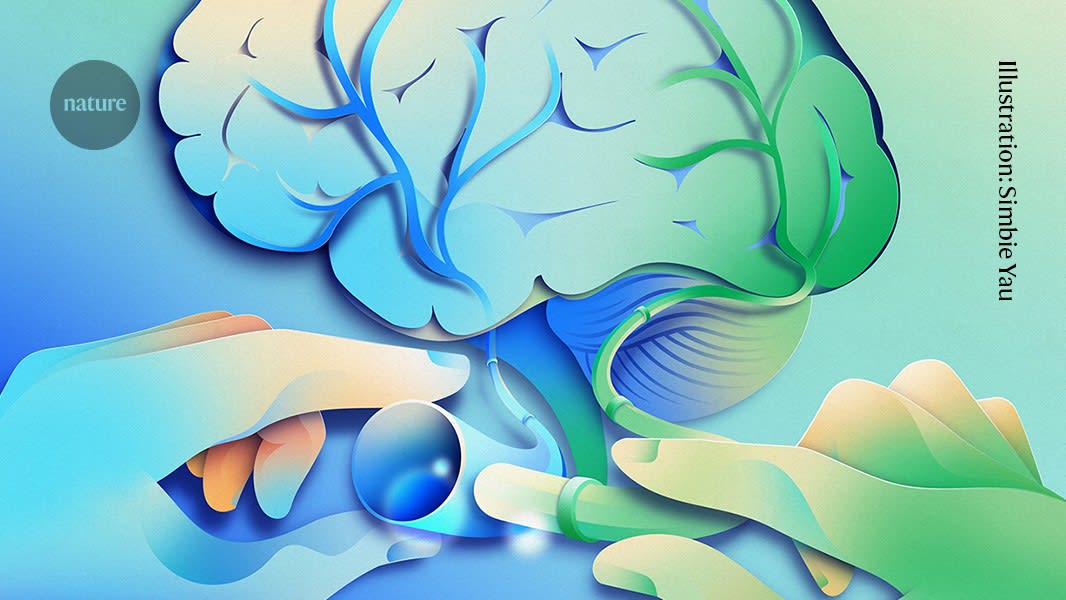 A controversial Alzheimer's surgery is said to reverse symptoms