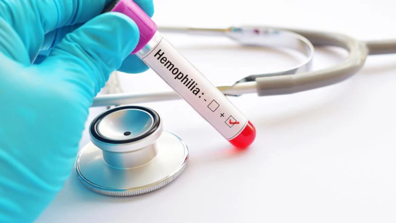 Maharashtra man suffered brain haemorrhage. Centre-allocated funds were available, yet he died