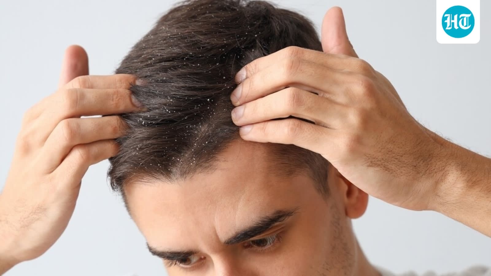 Scalp care is the new skin care, and it's time to care for our scalp, says a dermatologist