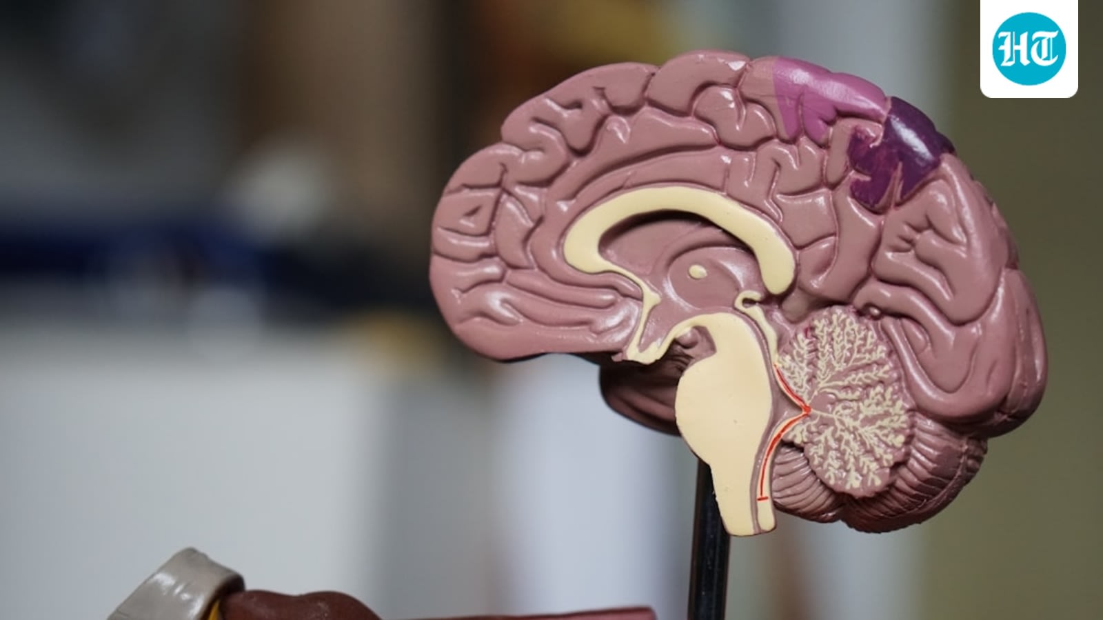 The skill nobody trains: Doctor explains why mental fitness is the foundation of peak performance
