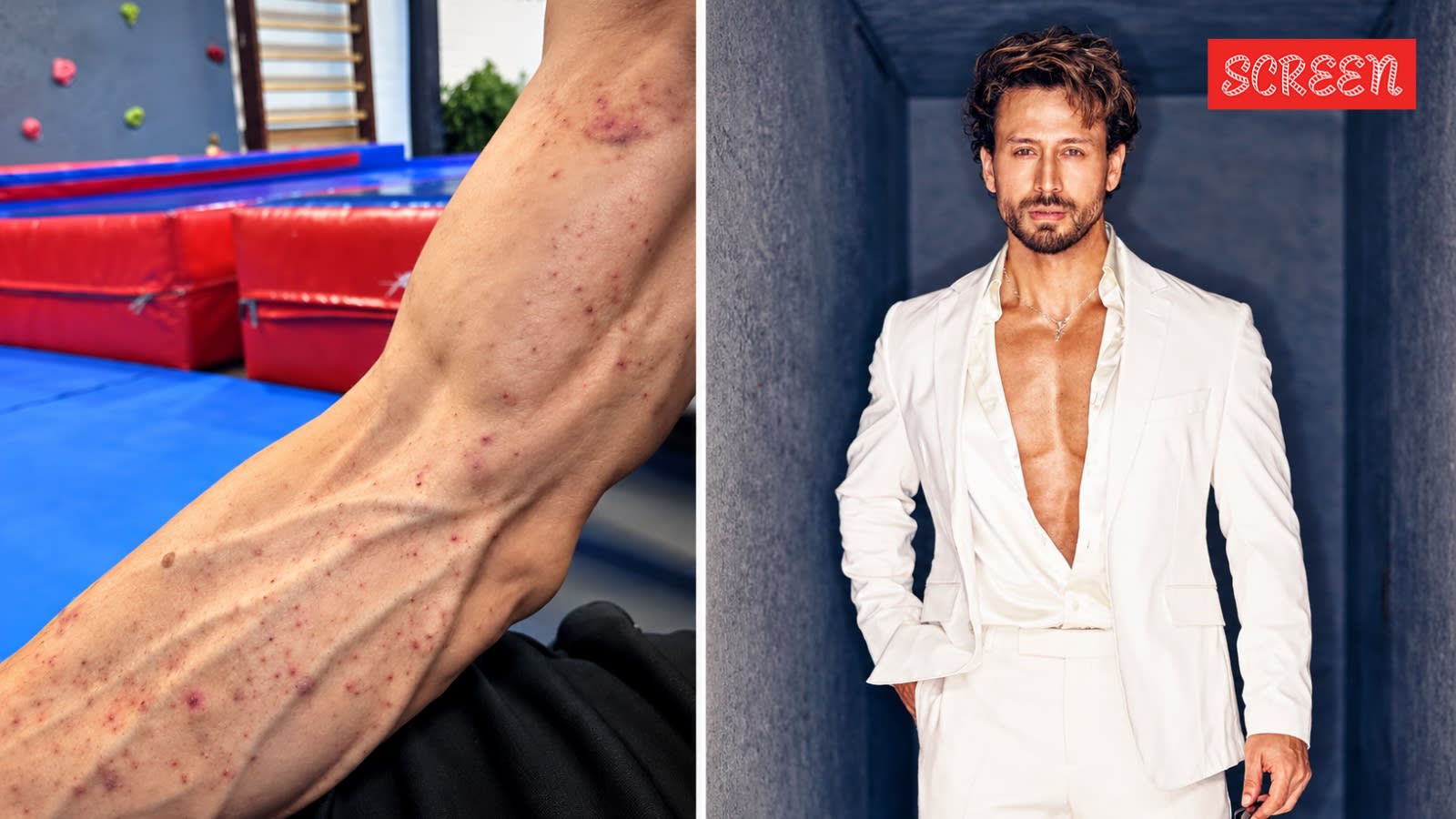 Tiger Shroff’s team shares injury video after firing incident: ‘God is kind’