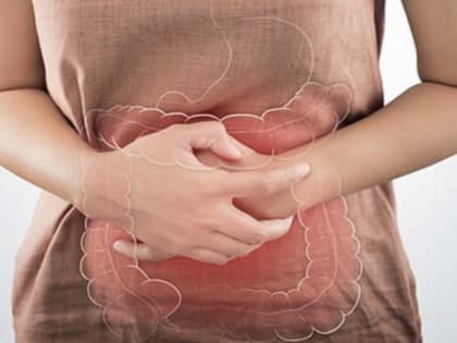 Что такое синдром раздраженного кишечника и как его распознать?