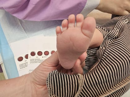 Влияние экологических изменений на здоровье населения