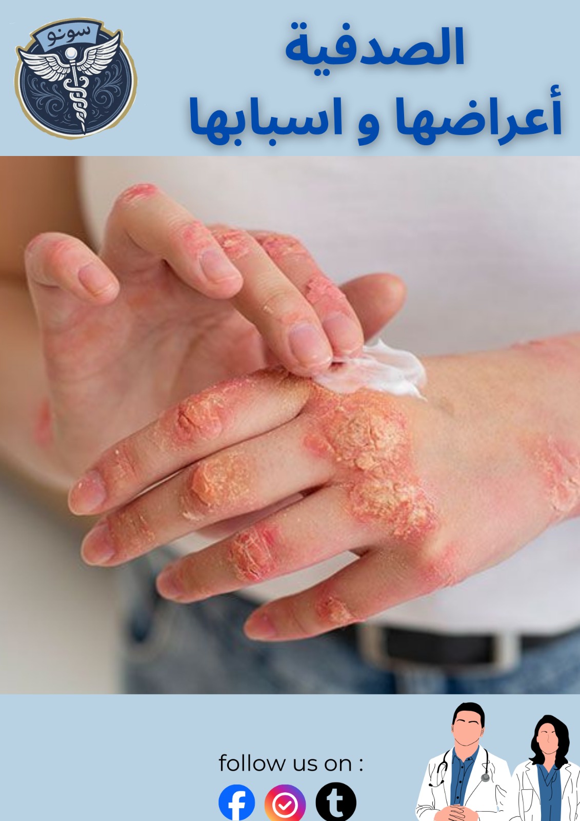 الصدفية… مرض مناعي مزمن يحتاج إلى فهم ودعم