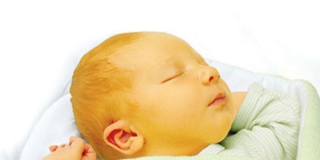 الصفراء ليست مجرد اصفرار الجلد الدكتور حسام عرفة يشرح الأسباب والعلاج والوقاية