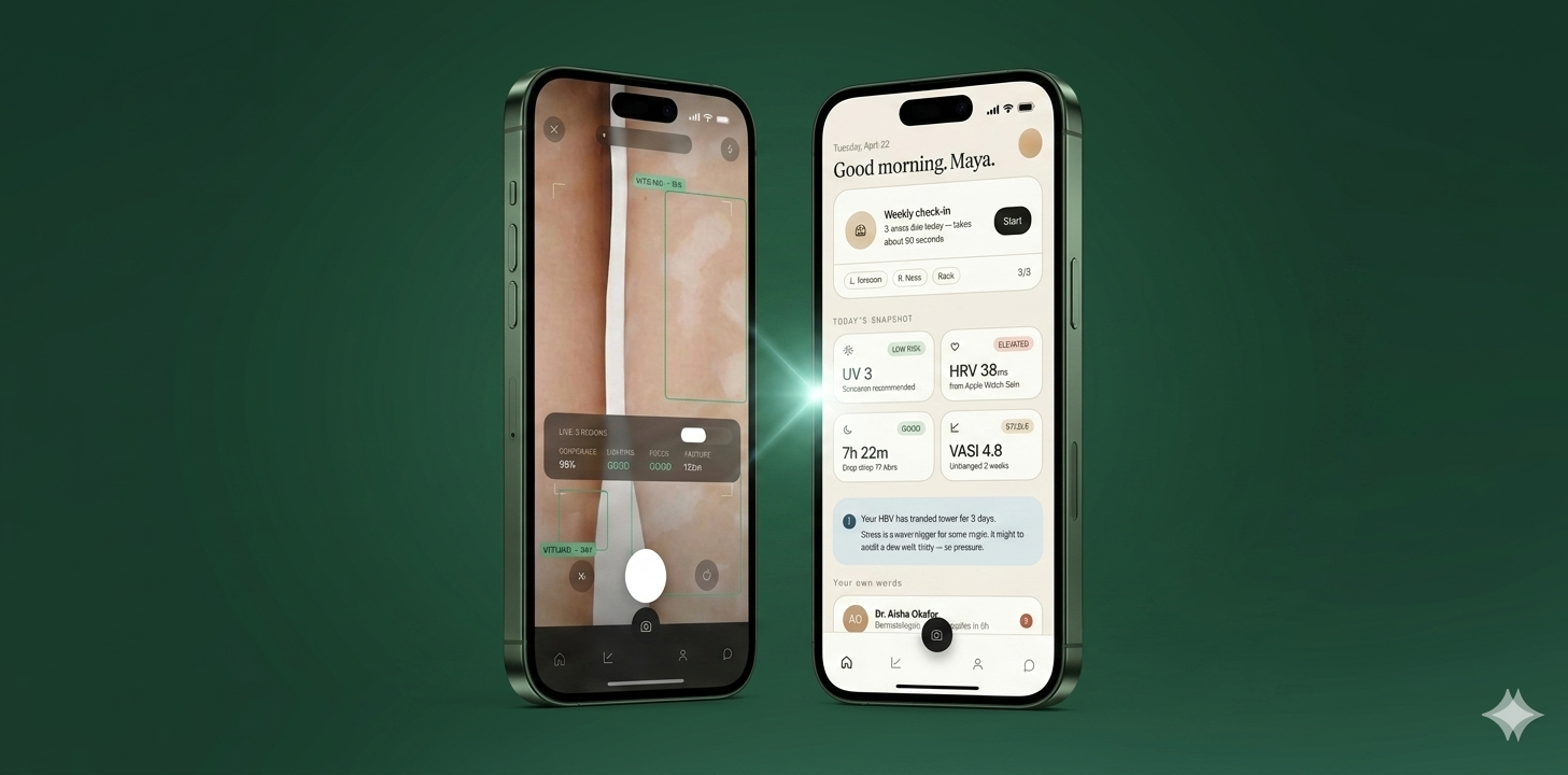 Vitiligo AI