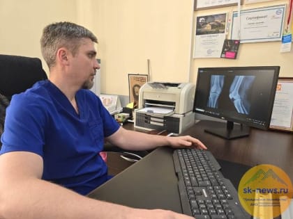 Алгоритм «Рентген коленного сустава» прошел предварительное клинико-техническое испытание на Ставрополье