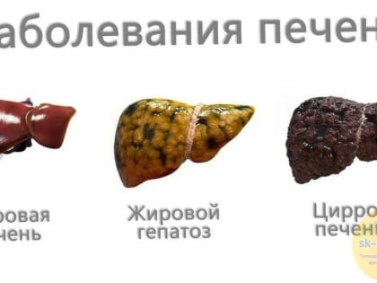 Долгоздрав Клуб: Нутрициолог должен начинать работу с печени, потому что это важнейший орган.
