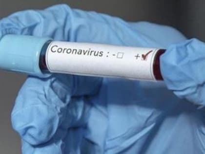 Оперативный штаб в КБР настоятельно рекомендует соблюдать меры профилактики от коронавируса