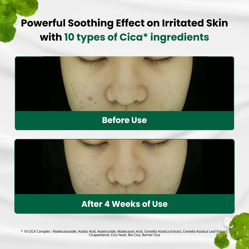 Dr.G Red Blemish Clear Soothing Cream 70ml thumbnail 3