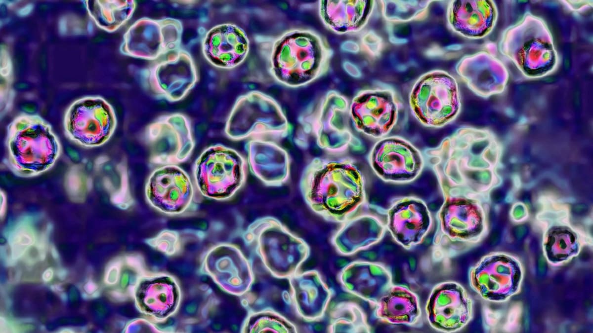 Pennsylvania Reports Third Measles Death in Three Weeks