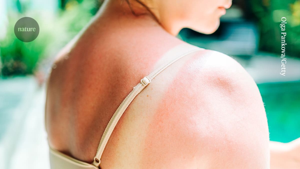 Moderna Cancer Vaccine Cuts Melanoma Recurrence Risk 42%