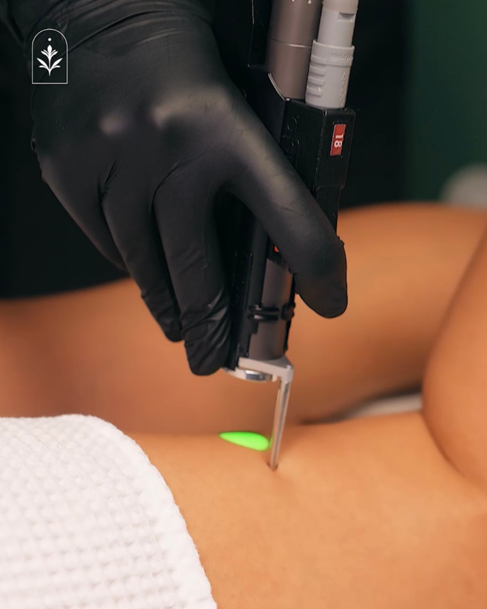 Traitement des Taches Pigmentaires Corporelles