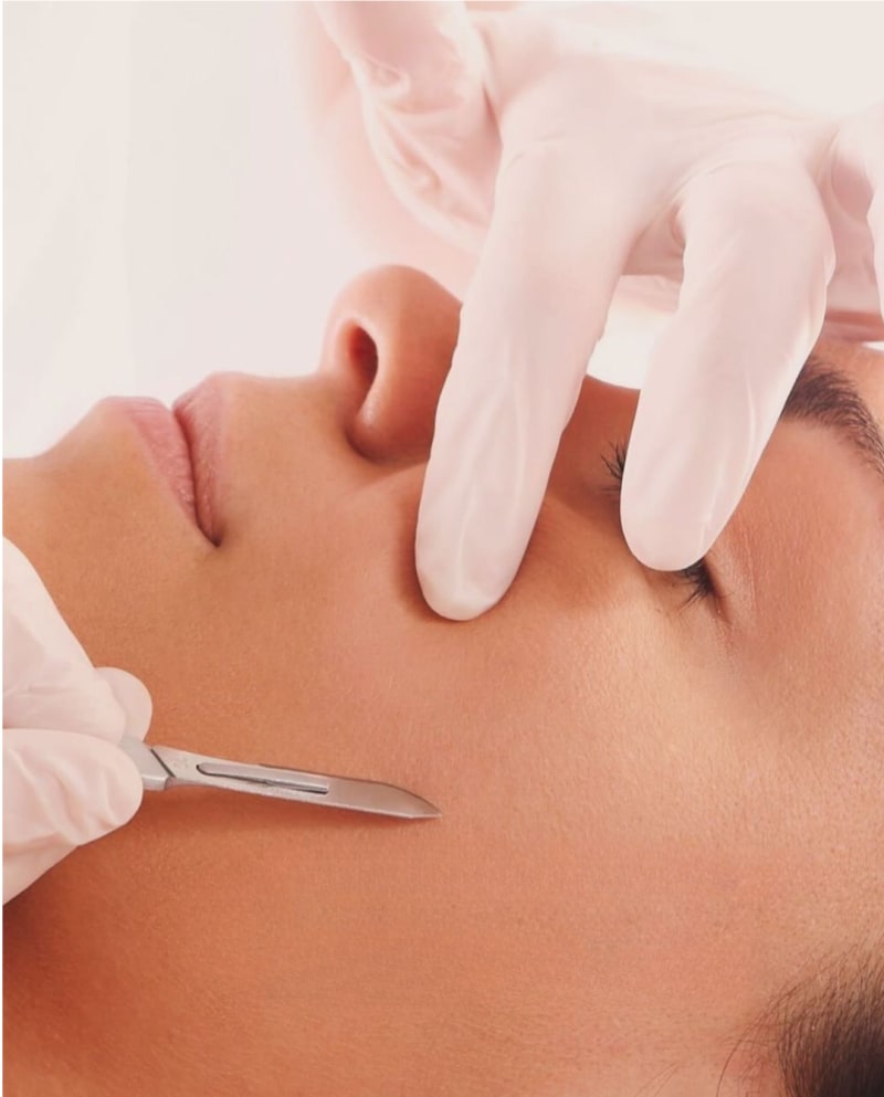 Dermaplaning