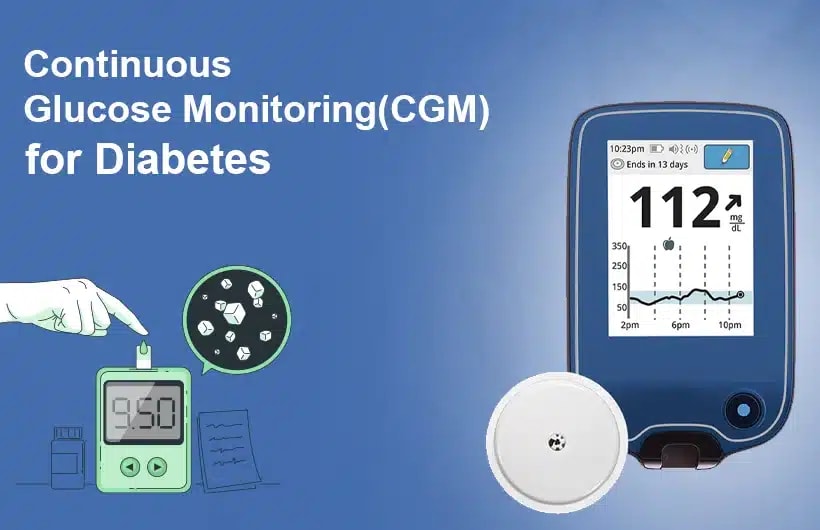 CGM for Non-Diabetics: Real-Time Glucose Tracking Guide