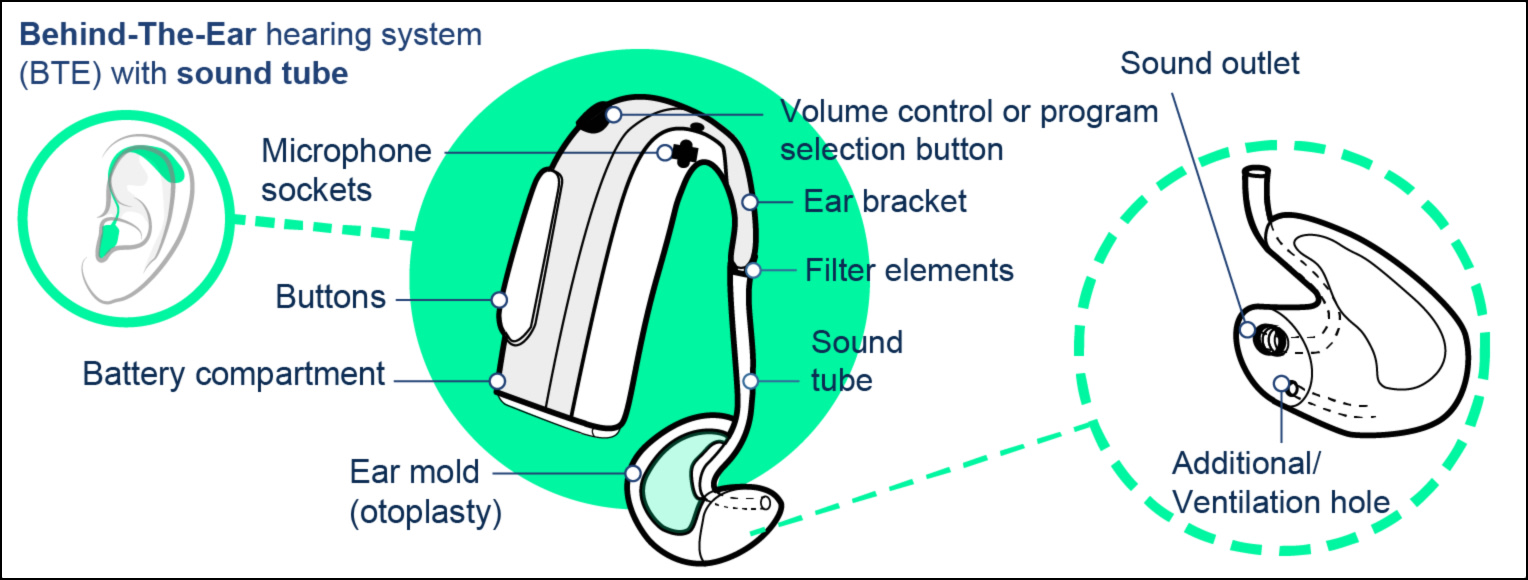 Behind the ear hearing system with external receiver