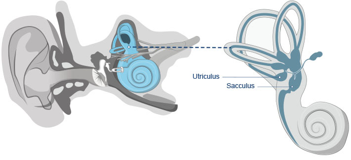Vertigo Semicircular canals