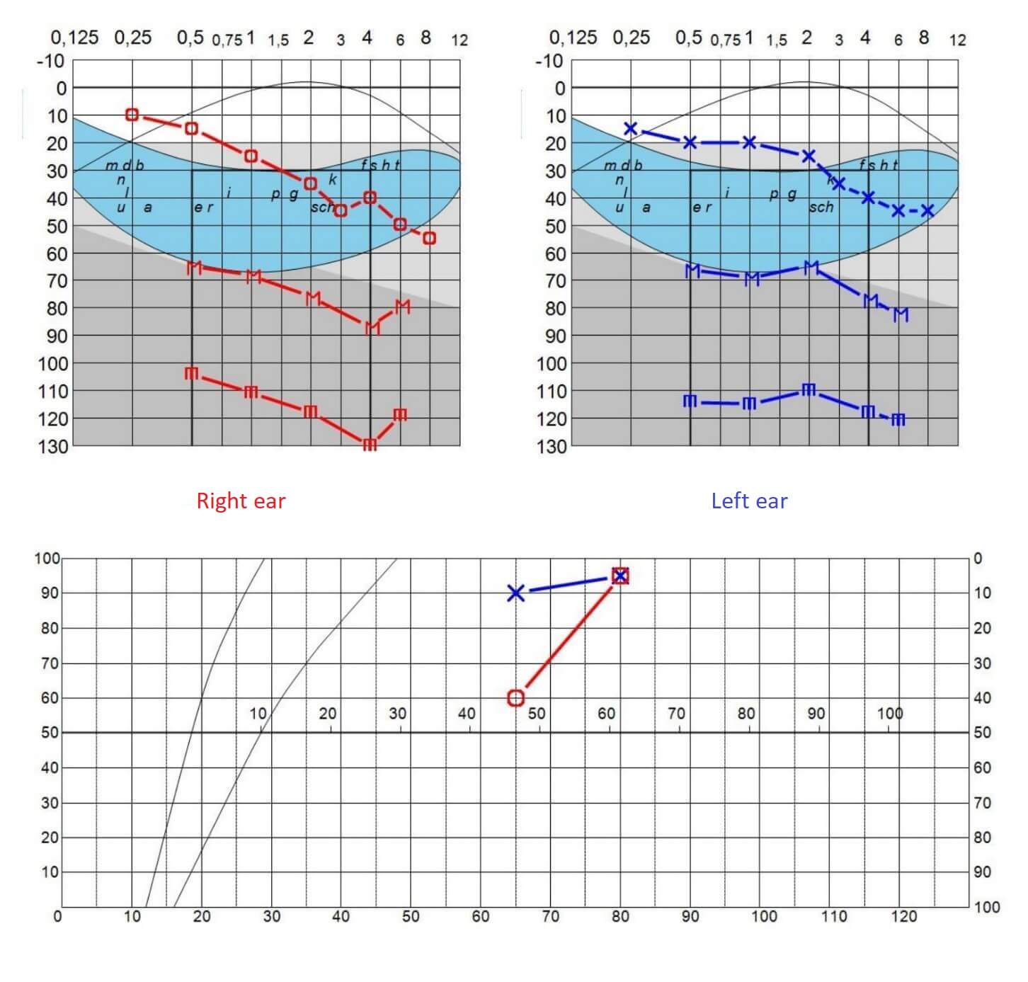 Audiogram