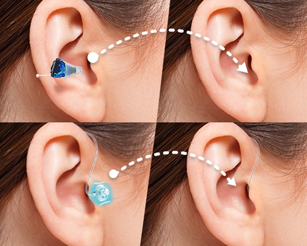 The Best Hearing Aids & Care For Hearing Loss