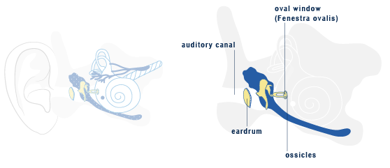 Combined hearing loss representation