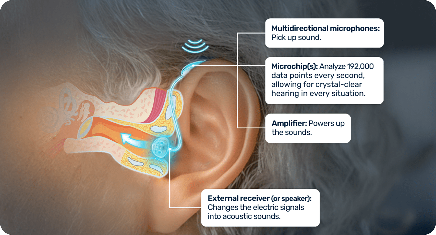 diagram of the ear showing how hearing aids work. Multidirectional microphones  picku pu the sound. The microchips analyze 192,000 data points ever second for crystal-clear hearing in every sitaution. The ampifier powers up the sound and the exteneral receiver or speacker changes the electric ssignals into acoustic sounds.