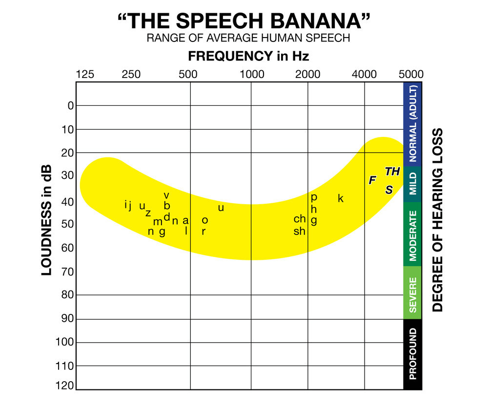 The Speech Banana Graph