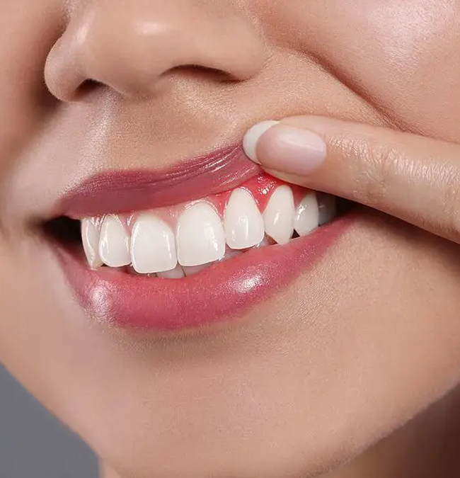 Healthy gums and smile