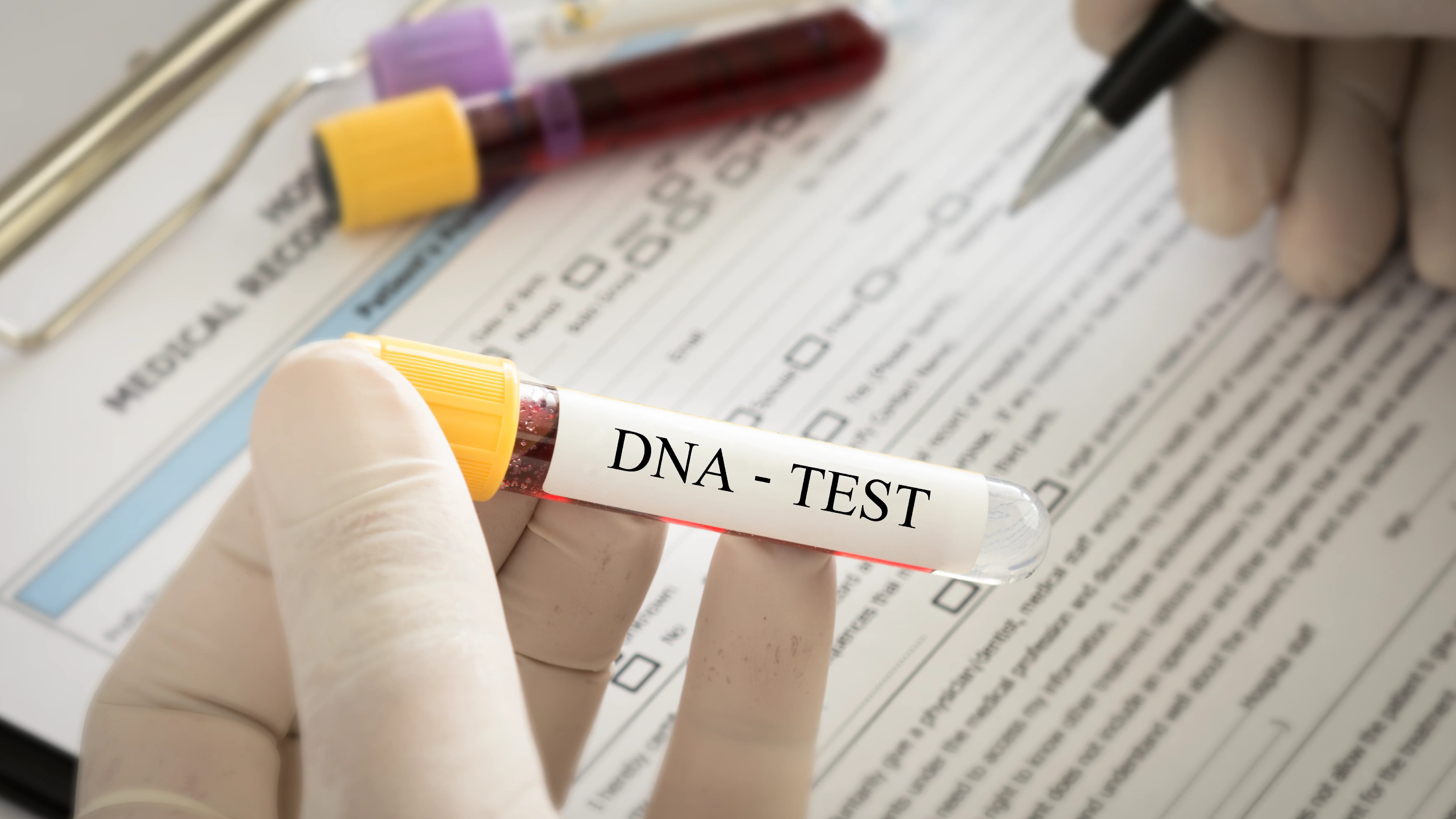 Systematically Using Autosomal DNA Test Results to Help Break Through Genealogical Brick Walls
