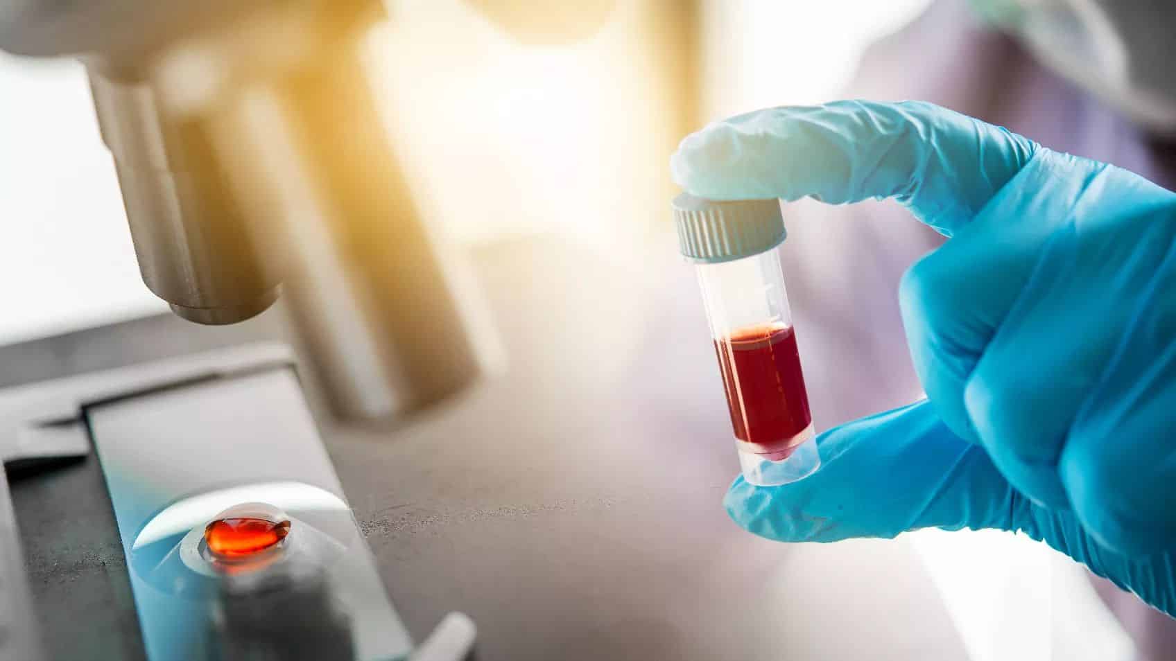 I Had My DNA Tested - Now What?