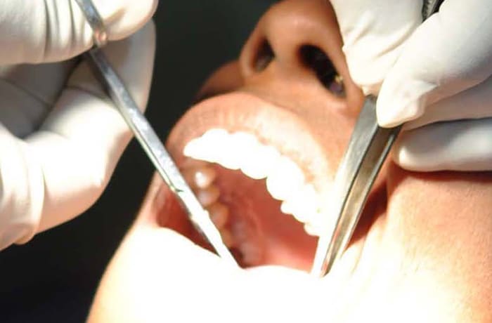 Dental surgeries image