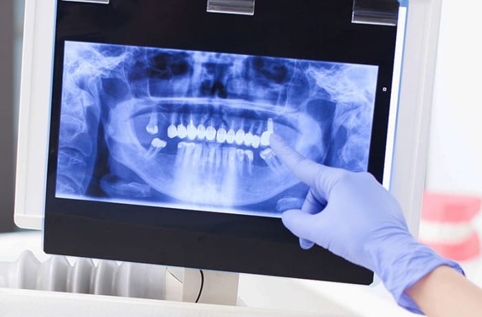 Dental surgeries image