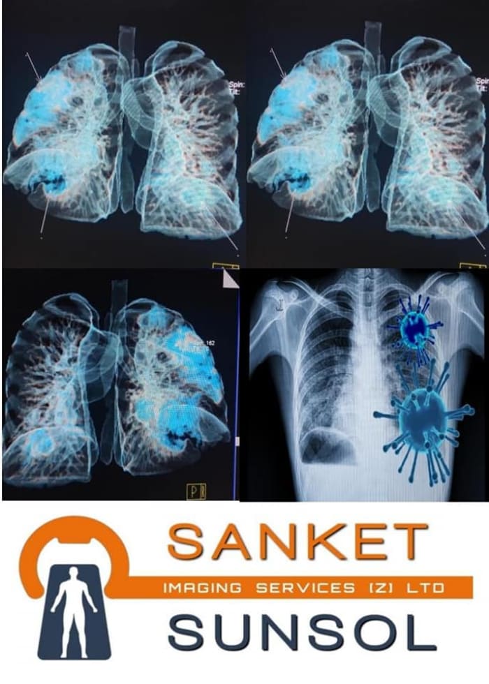 Prioritize Your Heart Health with Sunsol Imaging Services