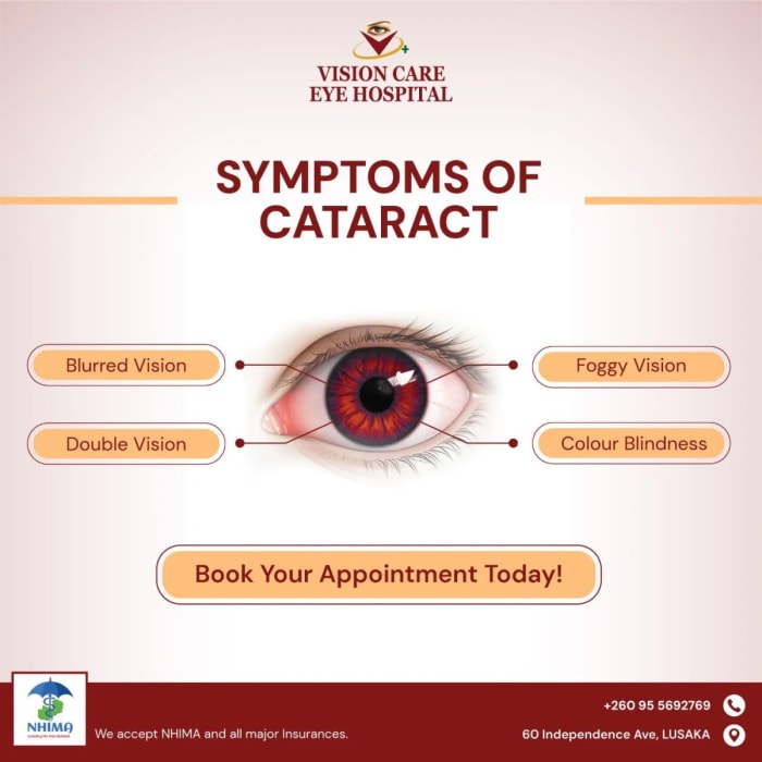 Noticing Cataract Symptoms? 