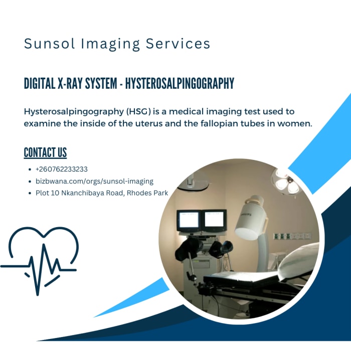 Advanced digital X-Ray for hysterosalpingography