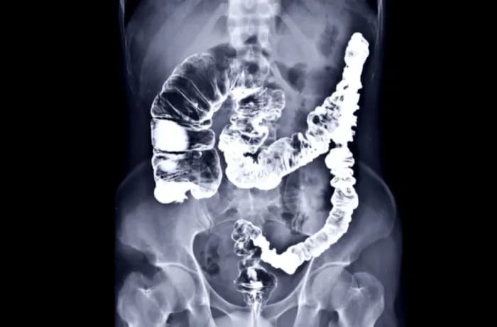 Digital X-Ray System