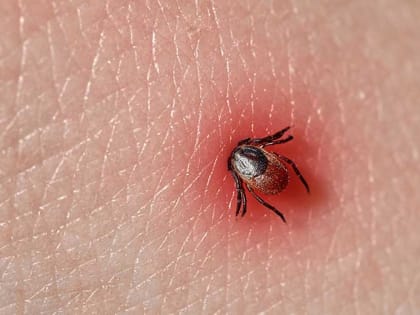 Россиян предупреждают о сезоне клещей