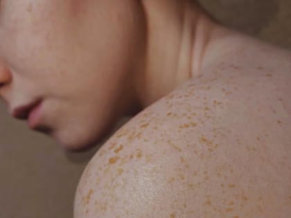 Тольяттинский врач рассказал, что может привести к злокачественным новообразованиям кожи